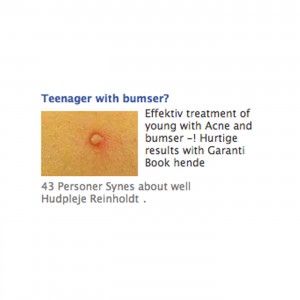 Teenager-with-bumser